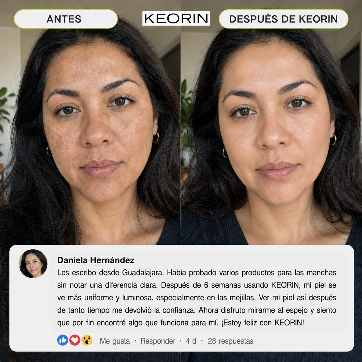 KEORIN Retinal Shot: rutina de uso