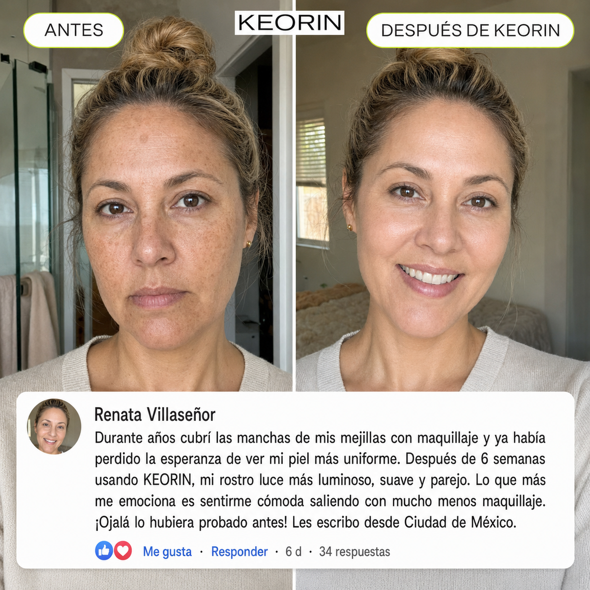 KEORIN Retinal Shot: ingredientes activos