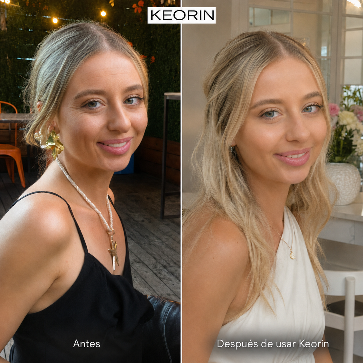 KEORIN Retinal Shot: antes y después