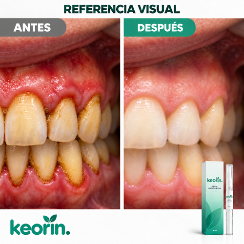 Antes y después con KEORIN