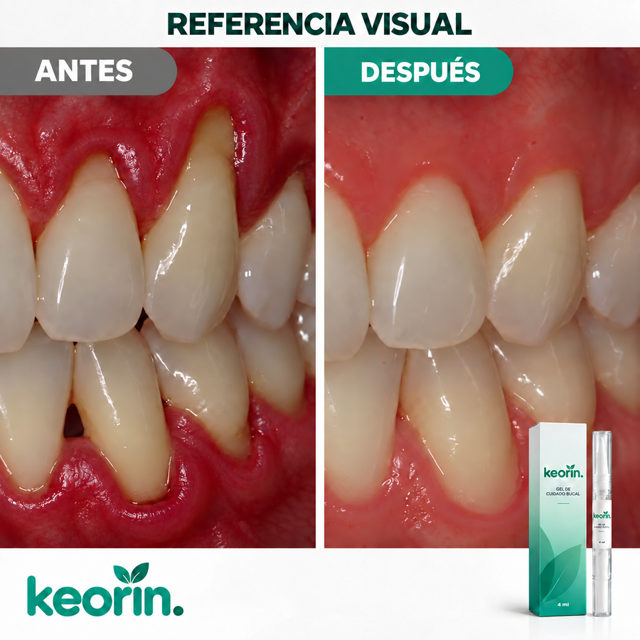Referencia visual antes y después